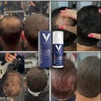 VOLUME+™️ Sofortiges Ergebnis